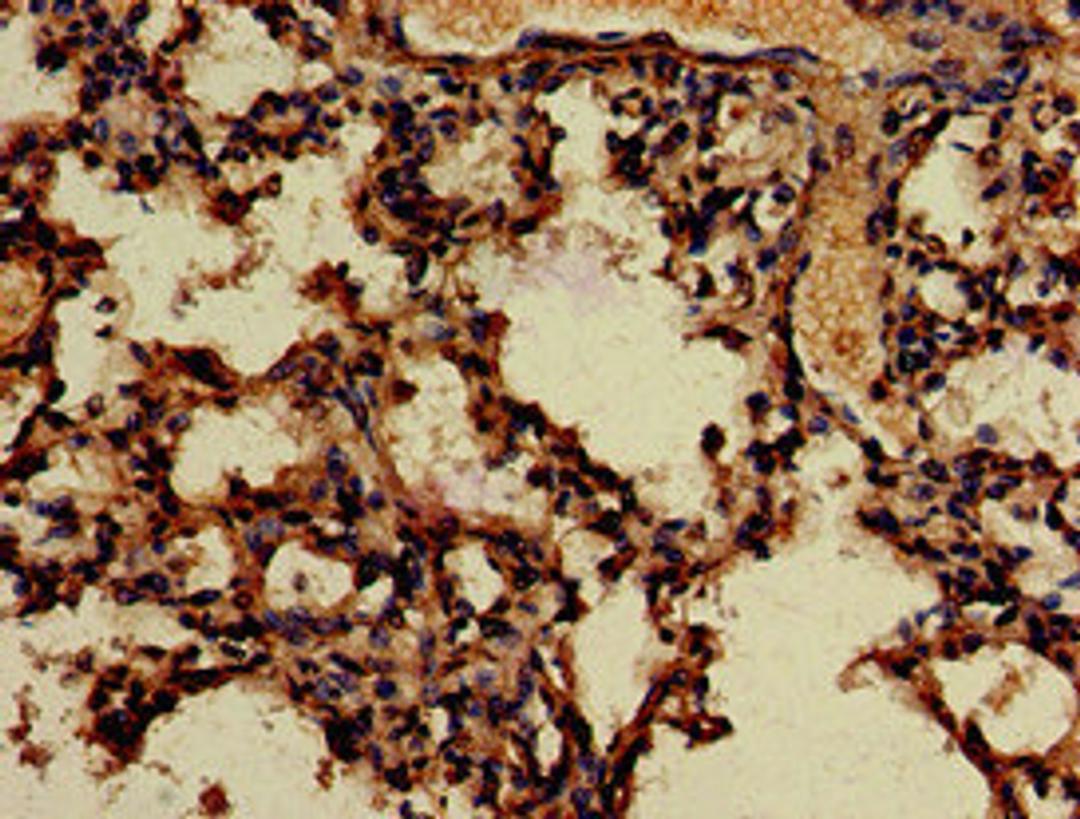 Immunohistochemistry of paraffin-embedded human lung tissue using CSB-PA823894LA01HU at dilution of 1:100