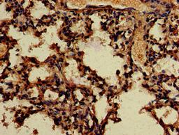 Immunohistochemistry of paraffin-embedded human lung tissue using CSB-PA823894LA01HU at dilution of 1:100