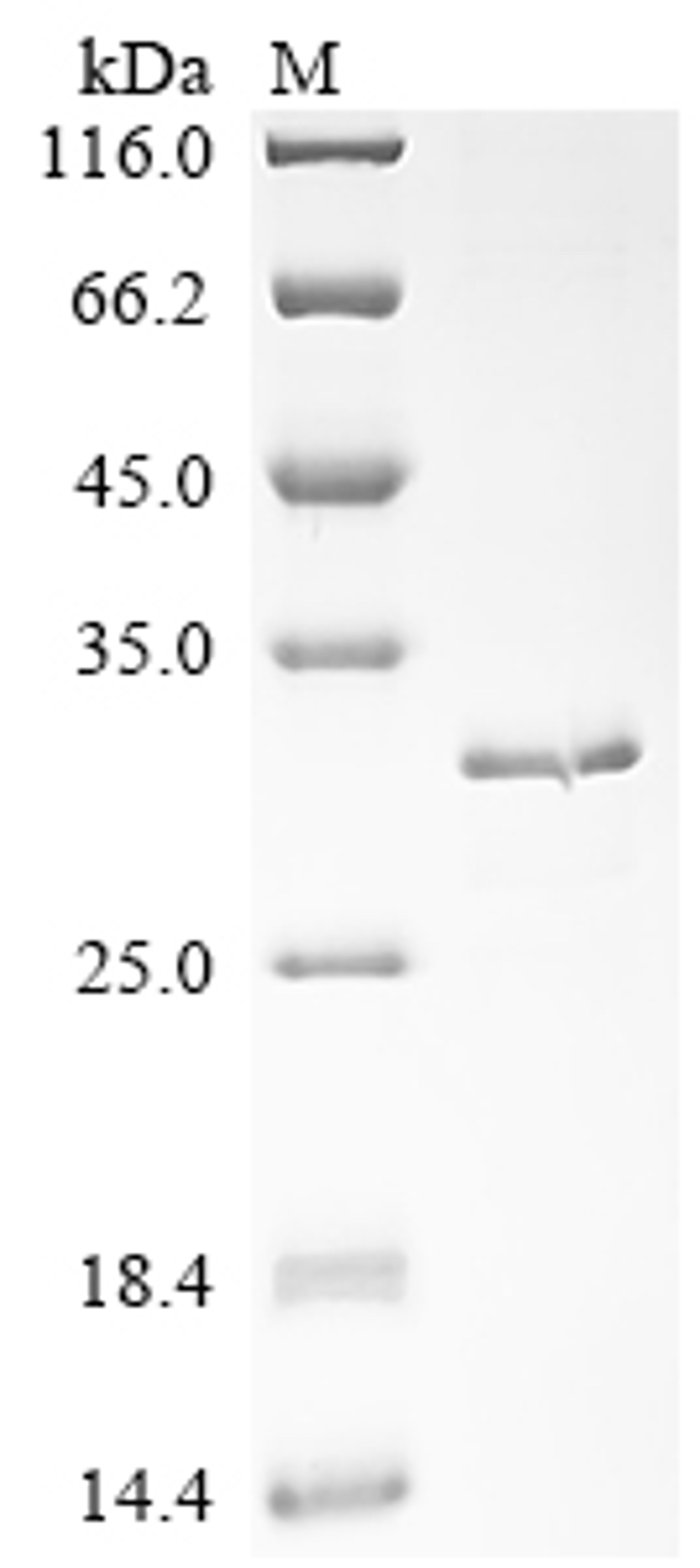 (Tris-Glycine gel) Discontinuous SDS-PAGE (reduced) with 5% enrichment gel and 15% separation gel.