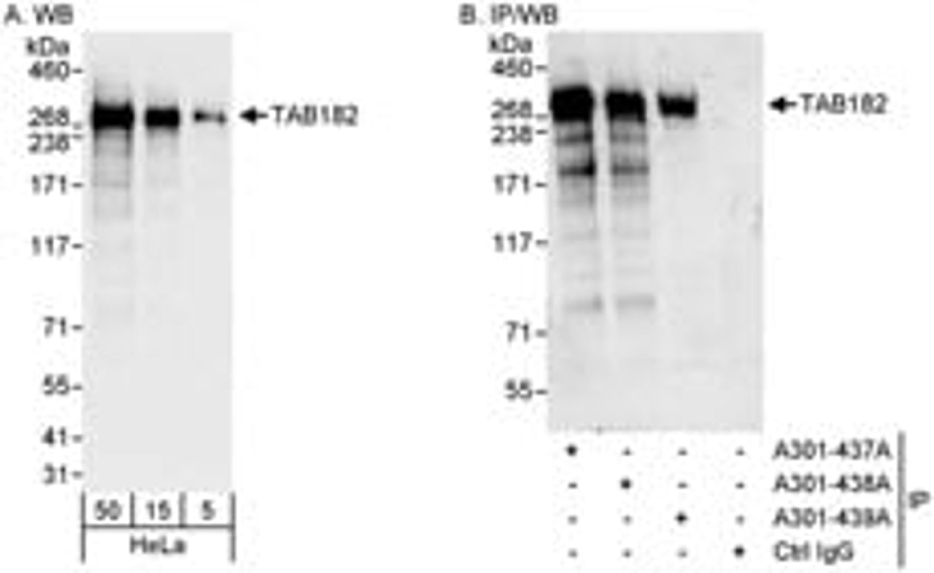 Detection of human TAB182 by western blot and immunoprecipitation.