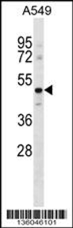 Western blot analysis in A549 cell line lysates (35ug/lane).