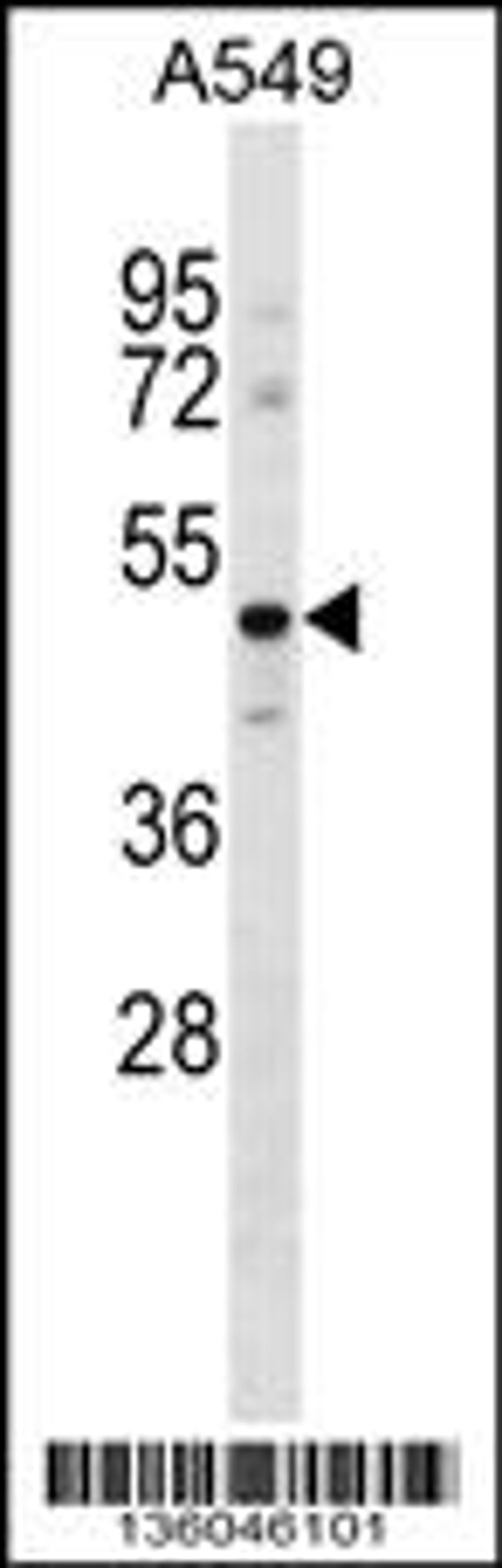 Western blot analysis in A549 cell line lysates (35ug/lane).