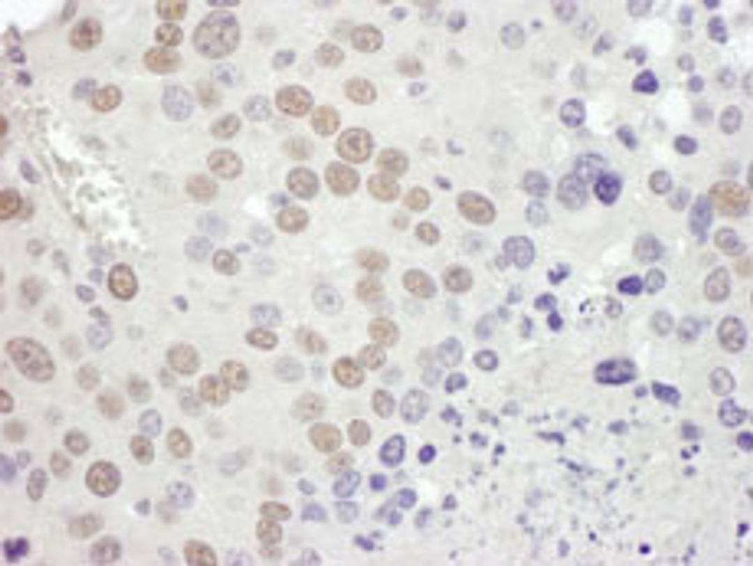 Detection of mouse MSH2 by immunohistochemistry.