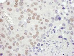 Detection of mouse MSH2 by immunohistochemistry.