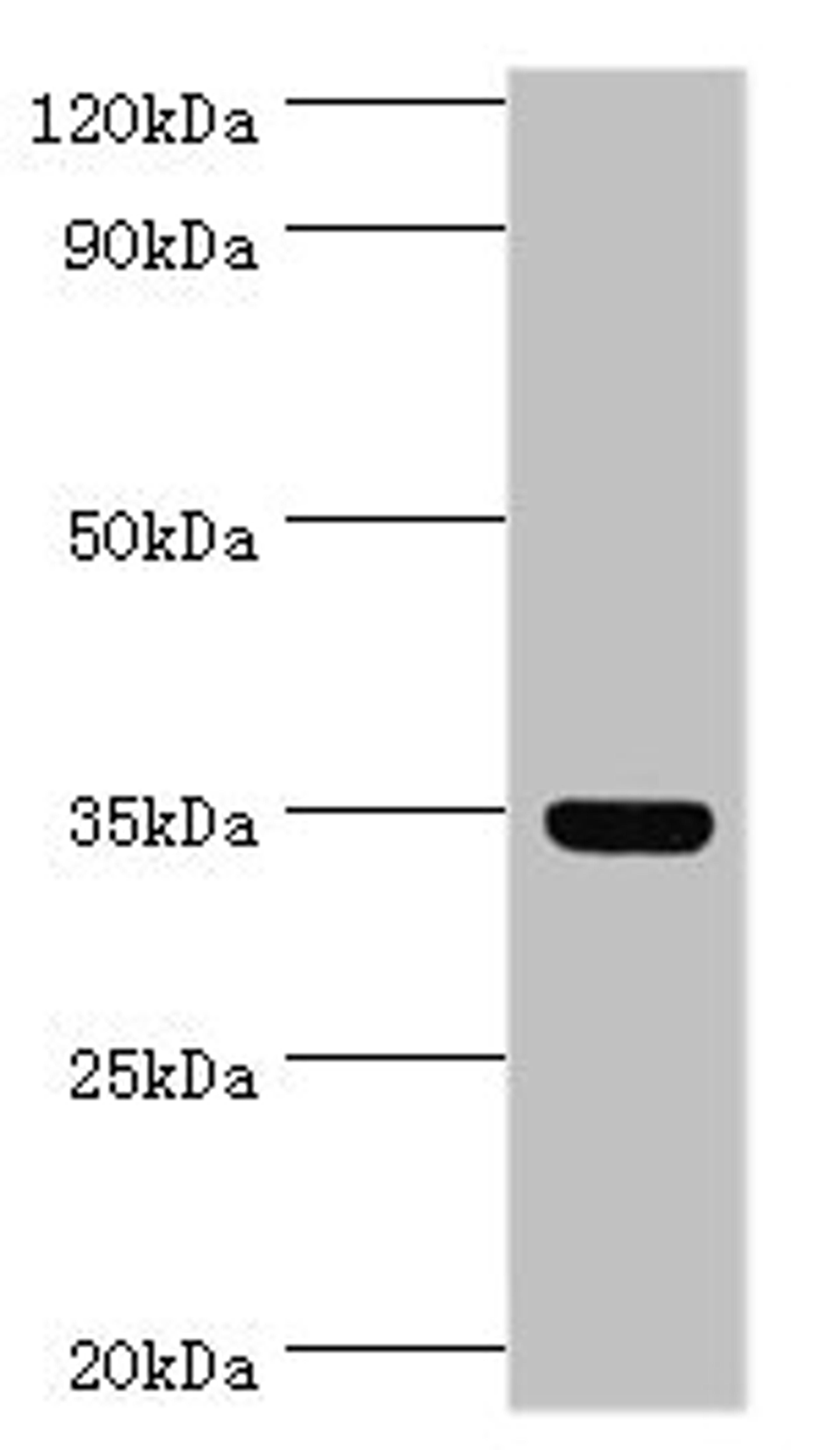 Western blot. All lanes: Arginase-1 antibody at 8ug/ml + Mouse liver tissue. Secondary. Goat polyclonal to rabbit IgG at 1/10000 dilution. Predicted band size: 35, 36, 26 kDa. Observed band size: 35 kDa. 