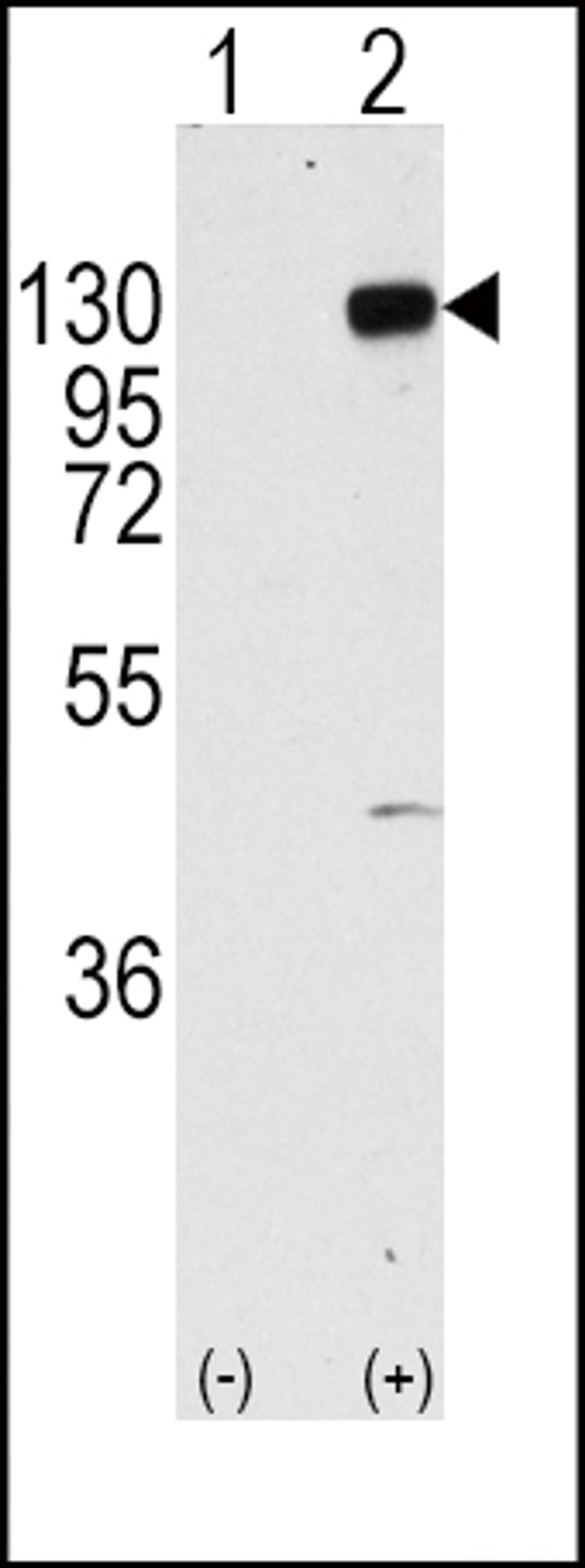 Western blot analysis of FGFR1 using rabbit polyclonal FGFR1 Antibody (Y766) using 293 cell lysates (2 ug/lane) either nontransfected (Lane 1) or transiently transfected with the FGFR1 gene (Lane 2).