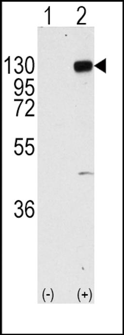 Western blot analysis of FGFR1 using rabbit polyclonal FGFR1 Antibody (Y766) using 293 cell lysates (2 ug/lane) either nontransfected (Lane 1) or transiently transfected with the FGFR1 gene (Lane 2).