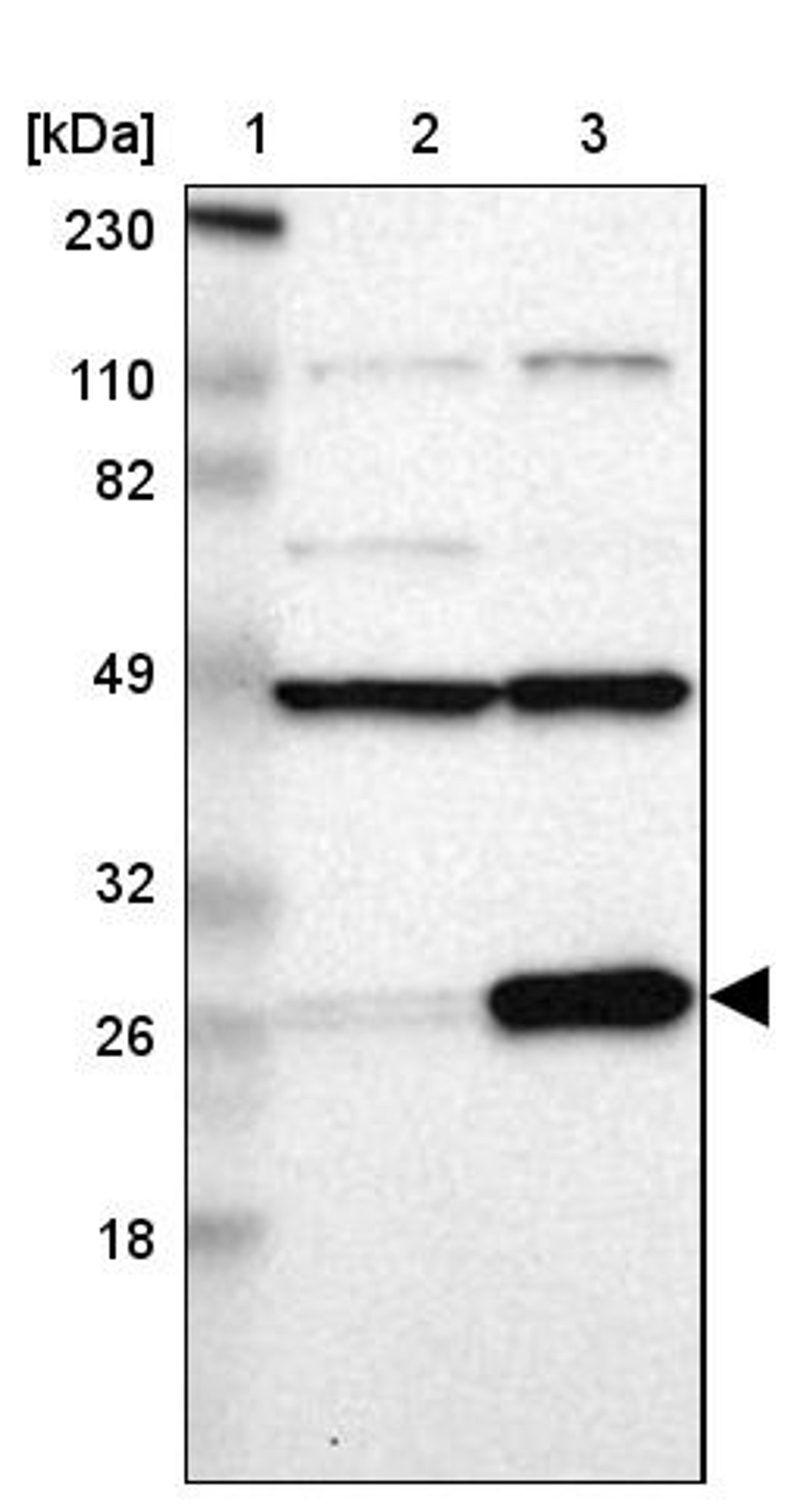 Western Blot: RPL14 Antibody [NBP1-85385] - Lane 1: Marker [kDa] 230, 110, 82, 49, 32, 26, 18<br/>Lane 2: Human cell line RT-4<br/>Lane 3: Human cell line U-251MG sp