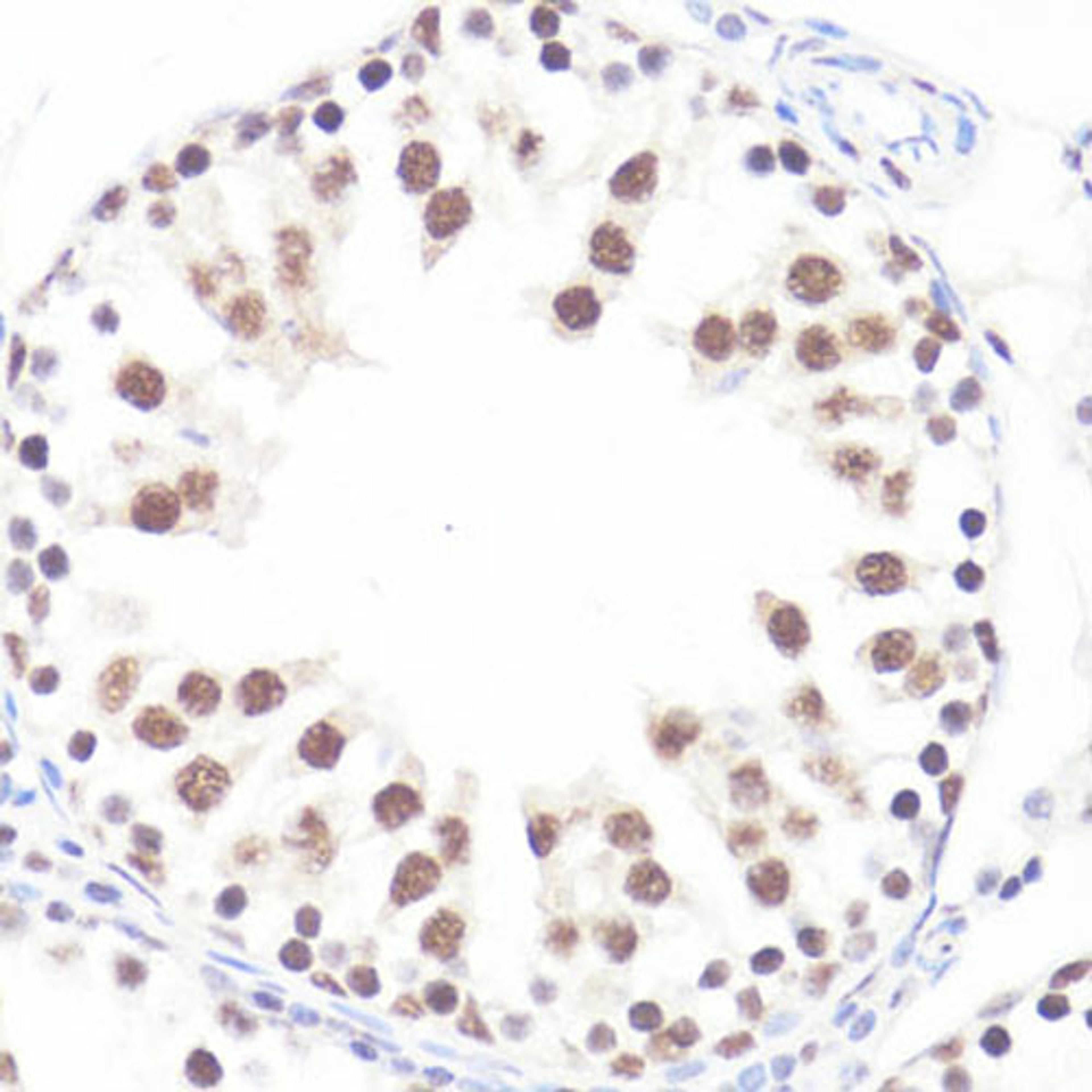 Immunohistochemistry - P-MYC-S62 antibody (AP0082)
