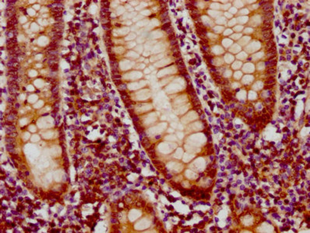 IHC image of CSB-PA839863LA01HU diluted at 1:300 and staining in paraffin-embedded human appendix tissue performed on a Leica BondTM system. After dewaxing and hydration, antigen retrieval was mediated by high pressure in a citrate buffer (pH 6.0). Section was blocked with 10% normal goat serum 30min at RT. Then primary antibody (1% BSA) was incubated at 4&deg;C overnight. The primary is detected by a biotinylated secondary antibody and visualized using an HRP conjugated SP system.