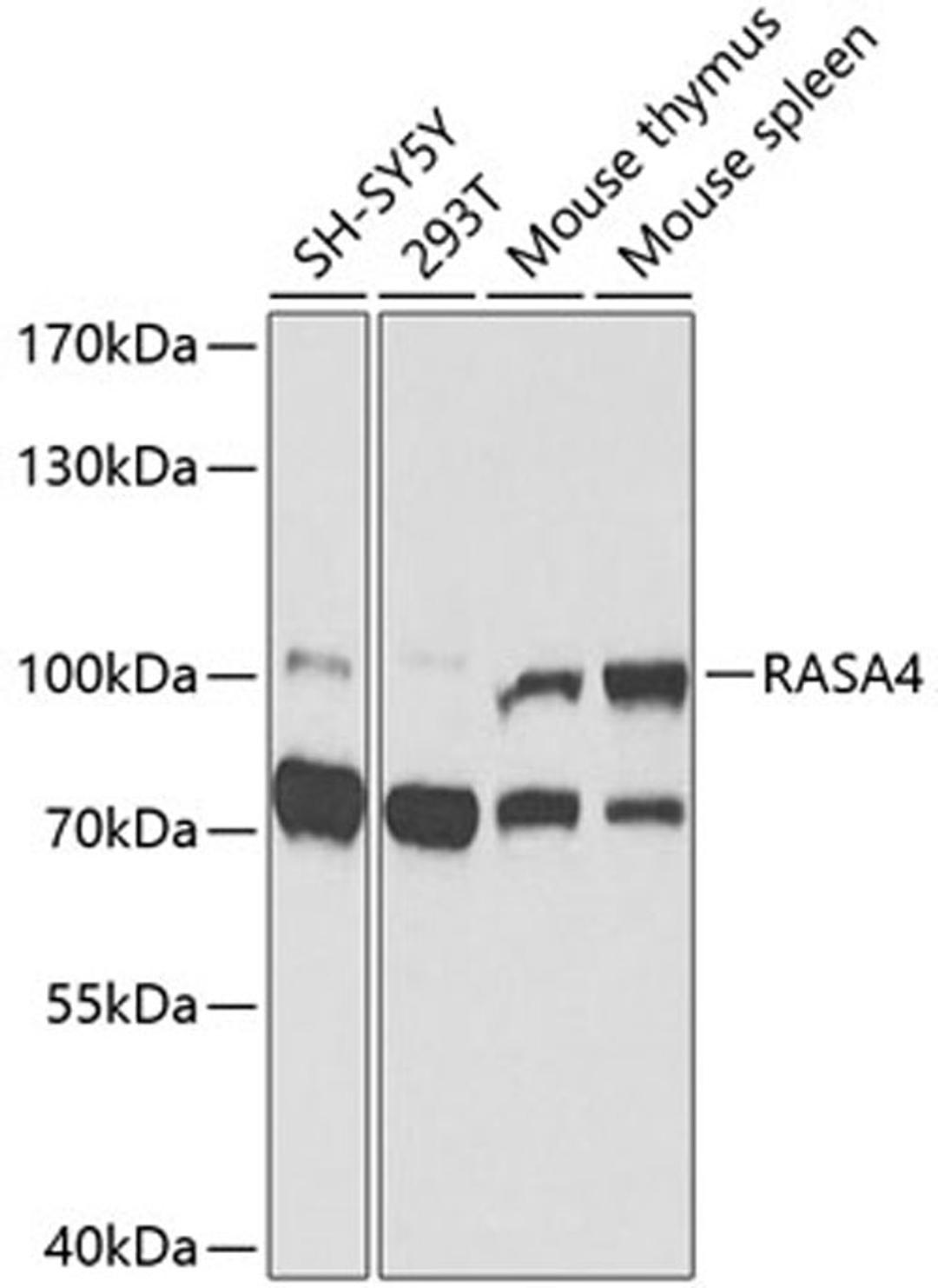 Western blot - RASA4 antibody (A9860)