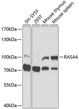 Western blot - RASA4 antibody (A9860)