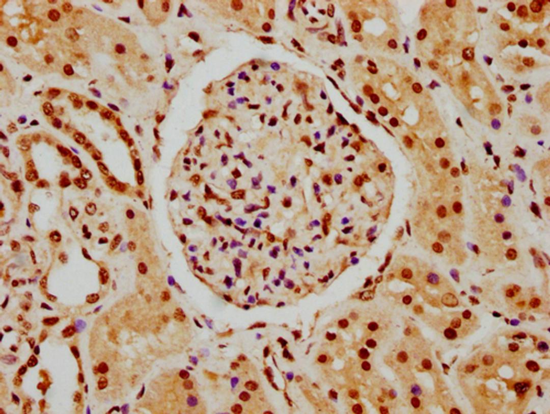 IHC image of CSB-PA010378PA45nhibHU diluted at 1:10 and staining in paraffin-embedded human kidney tissue performed on a Leica BondTM system. After dewaxing and hydration, antigen retrieval was mediated by high pressure in a citrate buffer (pH 6.0). Section was blocked with 10% normal goat serum 30min at RT. Then primary antibody (1% BSA) was incubated at 4°C overnight. The primary is detected by a biotinylated secondary antibody and visualized using an HRP conjugated SP system.