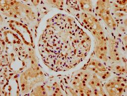 IHC image of CSB-PA010378PA45nhibHU diluted at 1:10 and staining in paraffin-embedded human kidney tissue performed on a Leica BondTM system. After dewaxing and hydration, antigen retrieval was mediated by high pressure in a citrate buffer (pH 6.0). Section was blocked with 10% normal goat serum 30min at RT. Then primary antibody (1% BSA) was incubated at 4°C overnight. The primary is detected by a biotinylated secondary antibody and visualized using an HRP conjugated SP system.