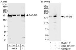 Detection of human CAP-D2 by western blot and immunoprecipitation.