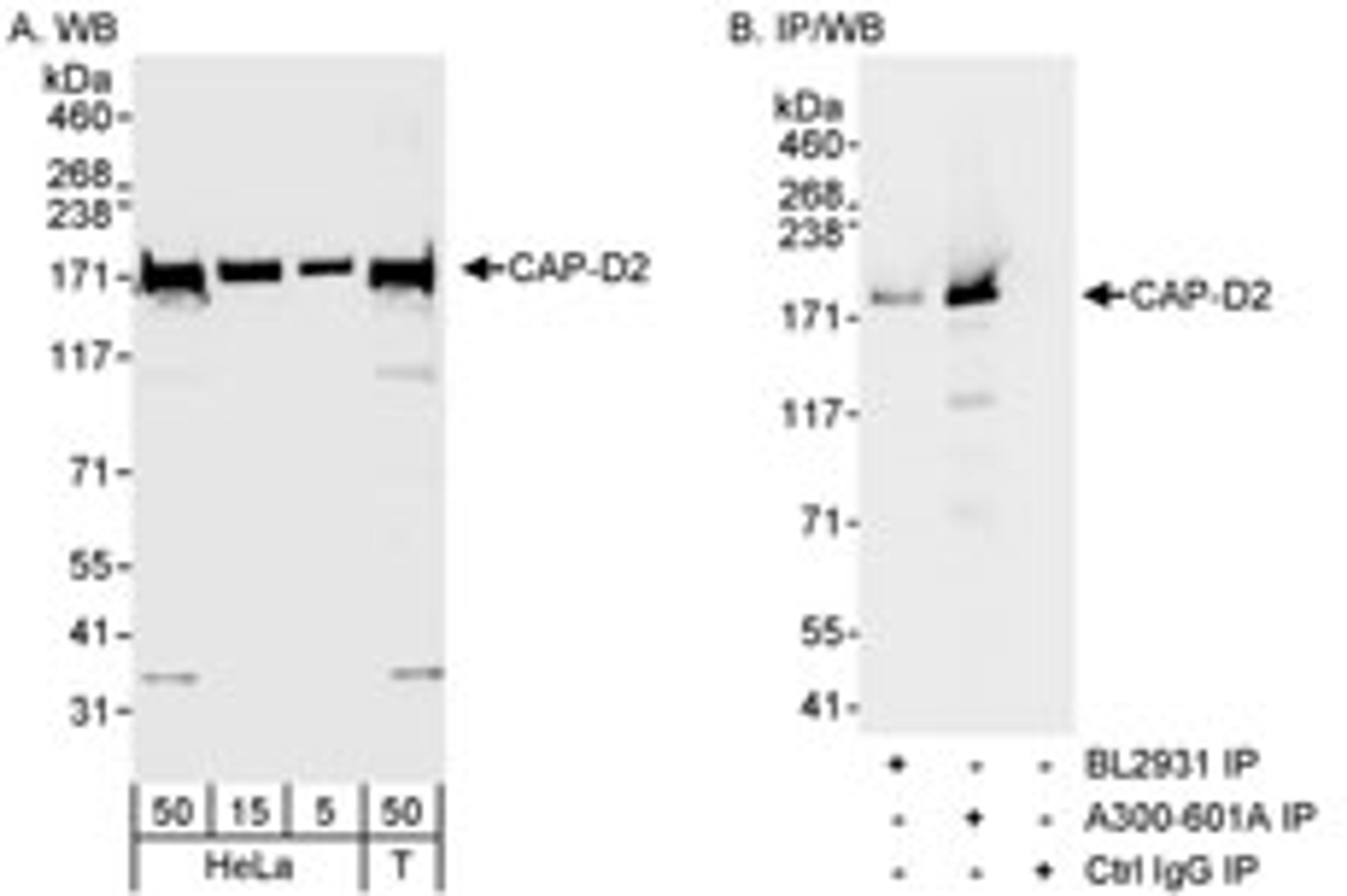 Detection of human CAP-D2 by western blot and immunoprecipitation.