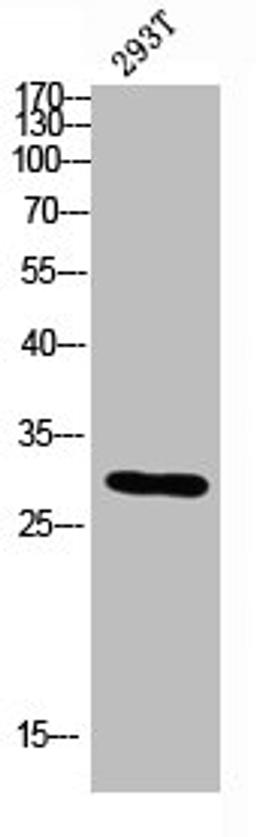 Western blot analysis of 293T lysis using CALB2 antibody. Antibody was diluted at 1:500. Secondary antibody was diluted at 1:20000