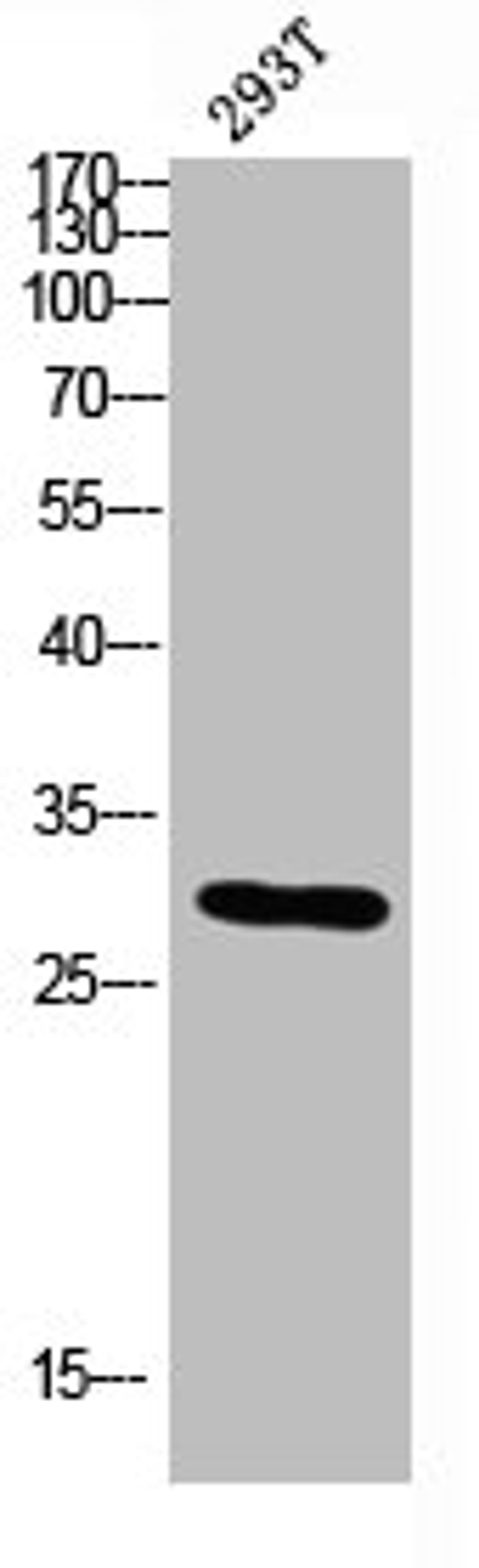 Western blot analysis of 293T lysis using CALB2 antibody. Antibody was diluted at 1:500. Secondary antibody was diluted at 1:20000