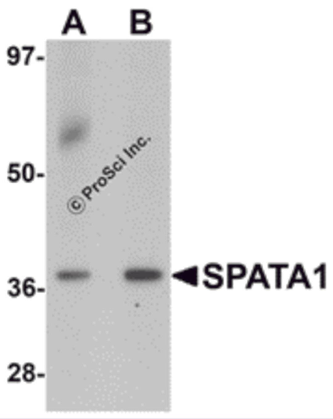 Western blot analysis of SPATA1 in A20 cell lysate with SPATA1 antibody at (A) 1 and (B) 2 μg/mL.