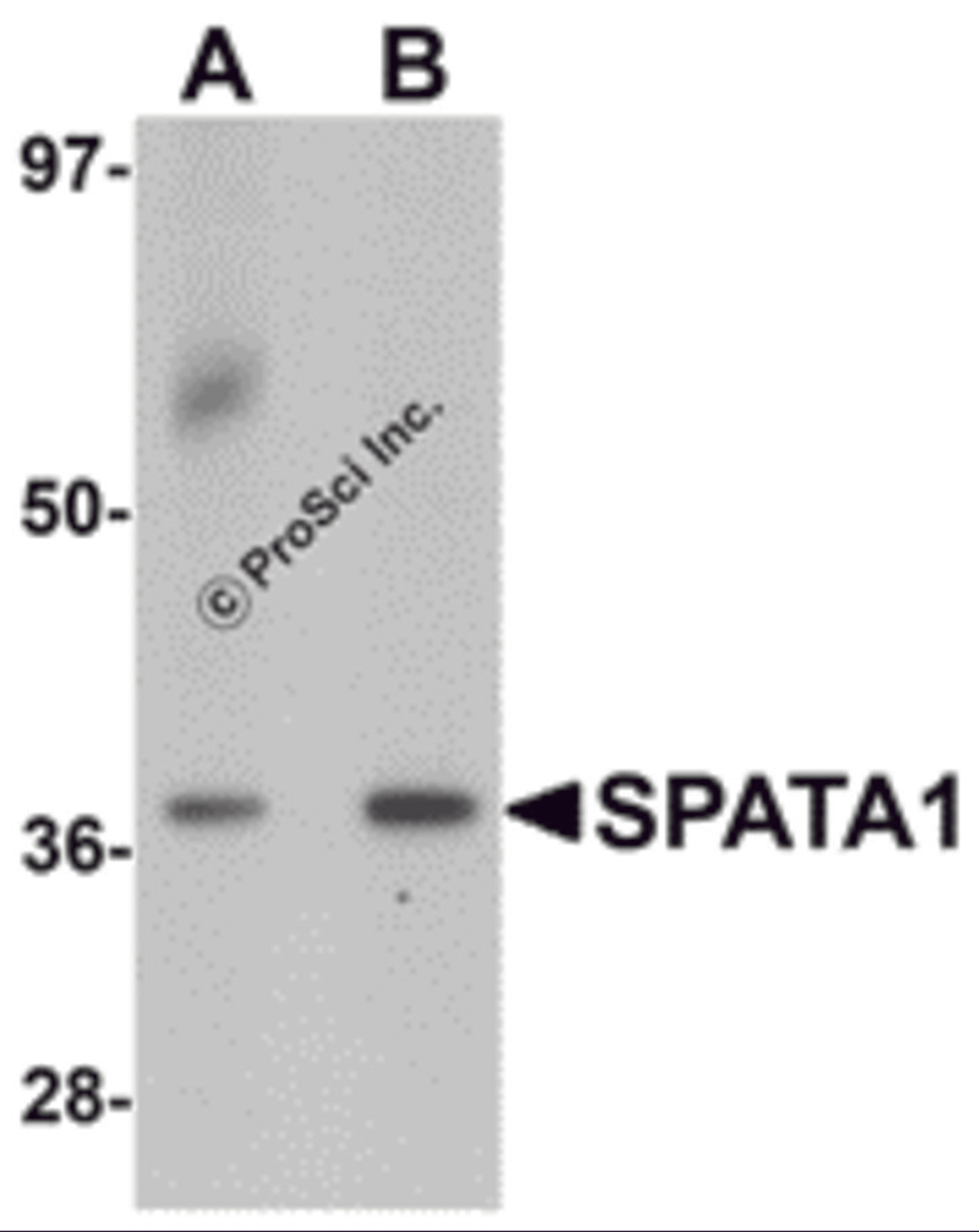 Western blot analysis of SPATA1 in A20 cell lysate with SPATA1 antibody at (A) 1 and (B) 2 μg/mL.