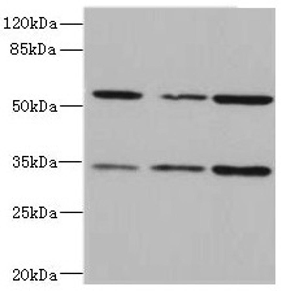 Western blot. All lanes: IL17RB antibody at 2.16µg/ml. Lane 1: 293T whole cell lysate. Lane 2: Hela whole cell lysate. Lane 3: HepG2 whole cell lysate. Secondary. Goat polyclonal to rabbit IgG at 1/10000 dilution. Predicted band size: 56, 32 kDa. Observed band size: 56, 32 kDa