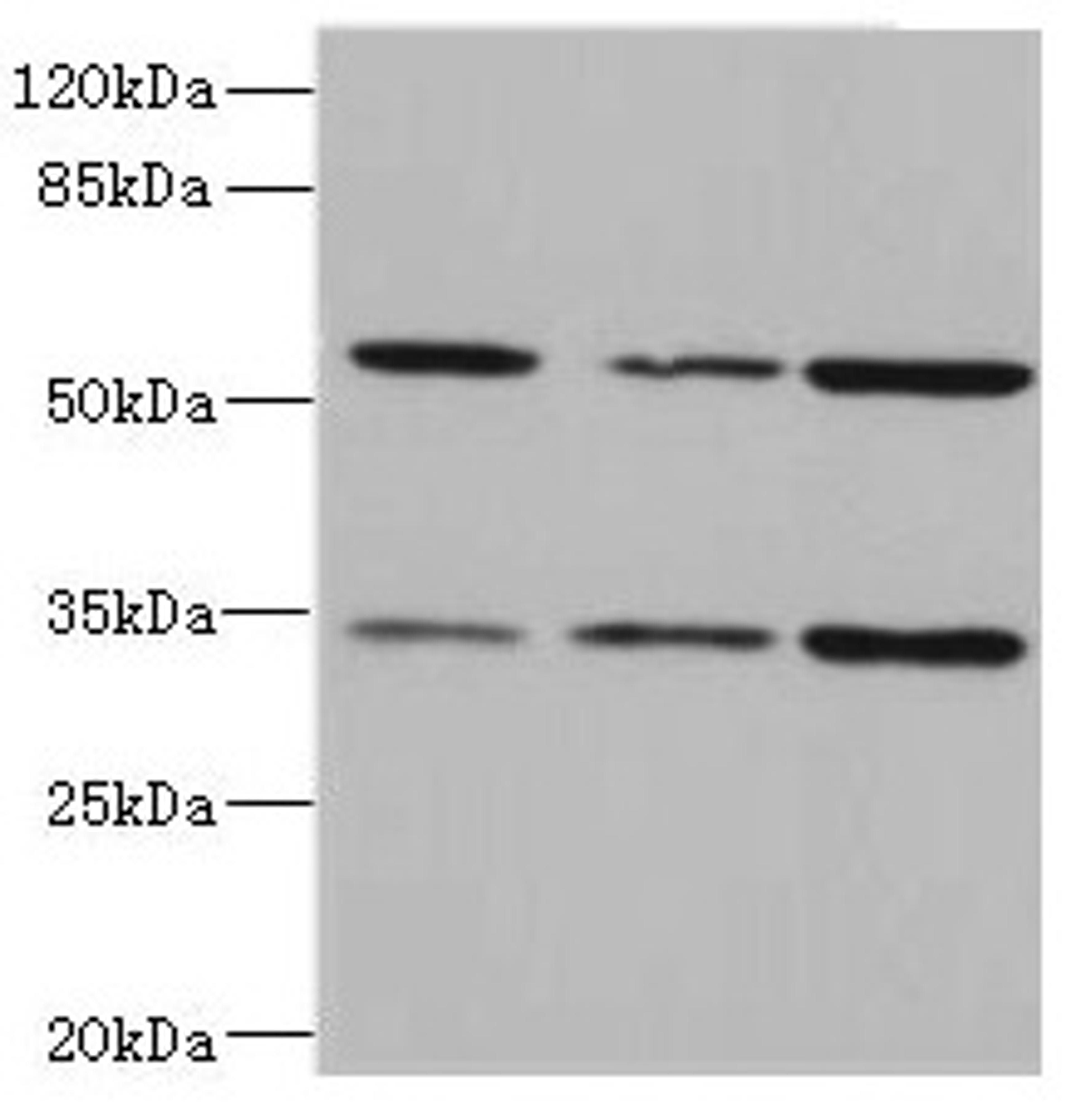 Western blot. All lanes: IL17RB antibody at 2.16µg/ml. Lane 1: 293T whole cell lysate. Lane 2: Hela whole cell lysate. Lane 3: HepG2 whole cell lysate. Secondary. Goat polyclonal to rabbit IgG at 1/10000 dilution. Predicted band size: 56, 32 kDa. Observed band size: 56, 32 kDa