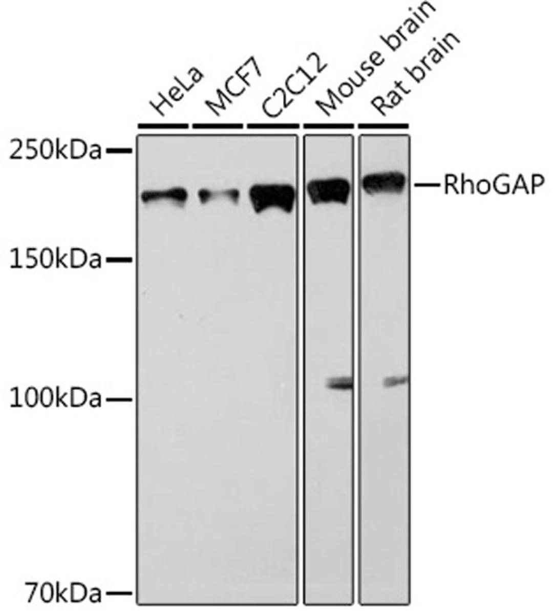 Western blot - RhoGAP Rabbit mAb (A2330)