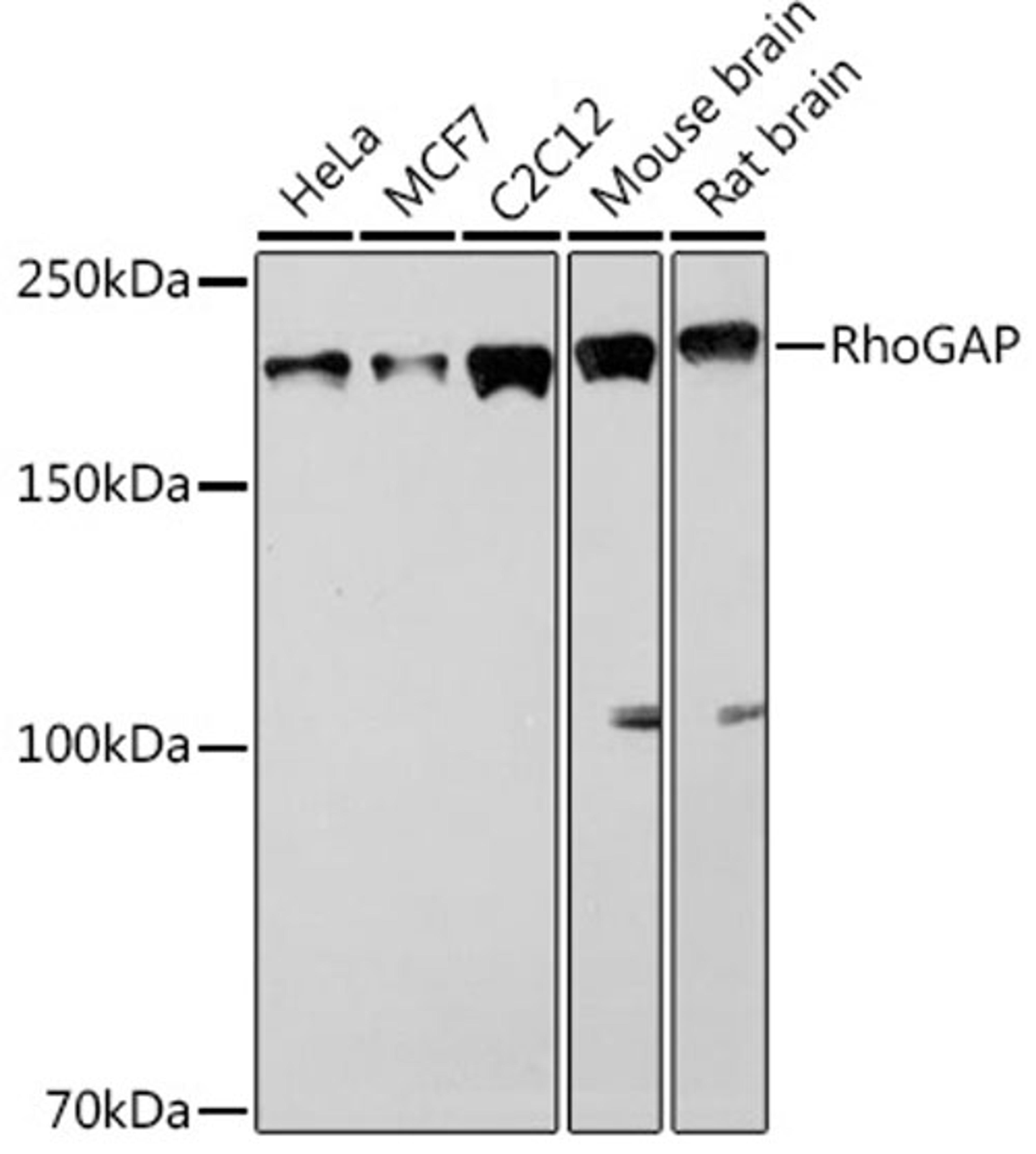 Western blot - RhoGAP Rabbit mAb (A2330)