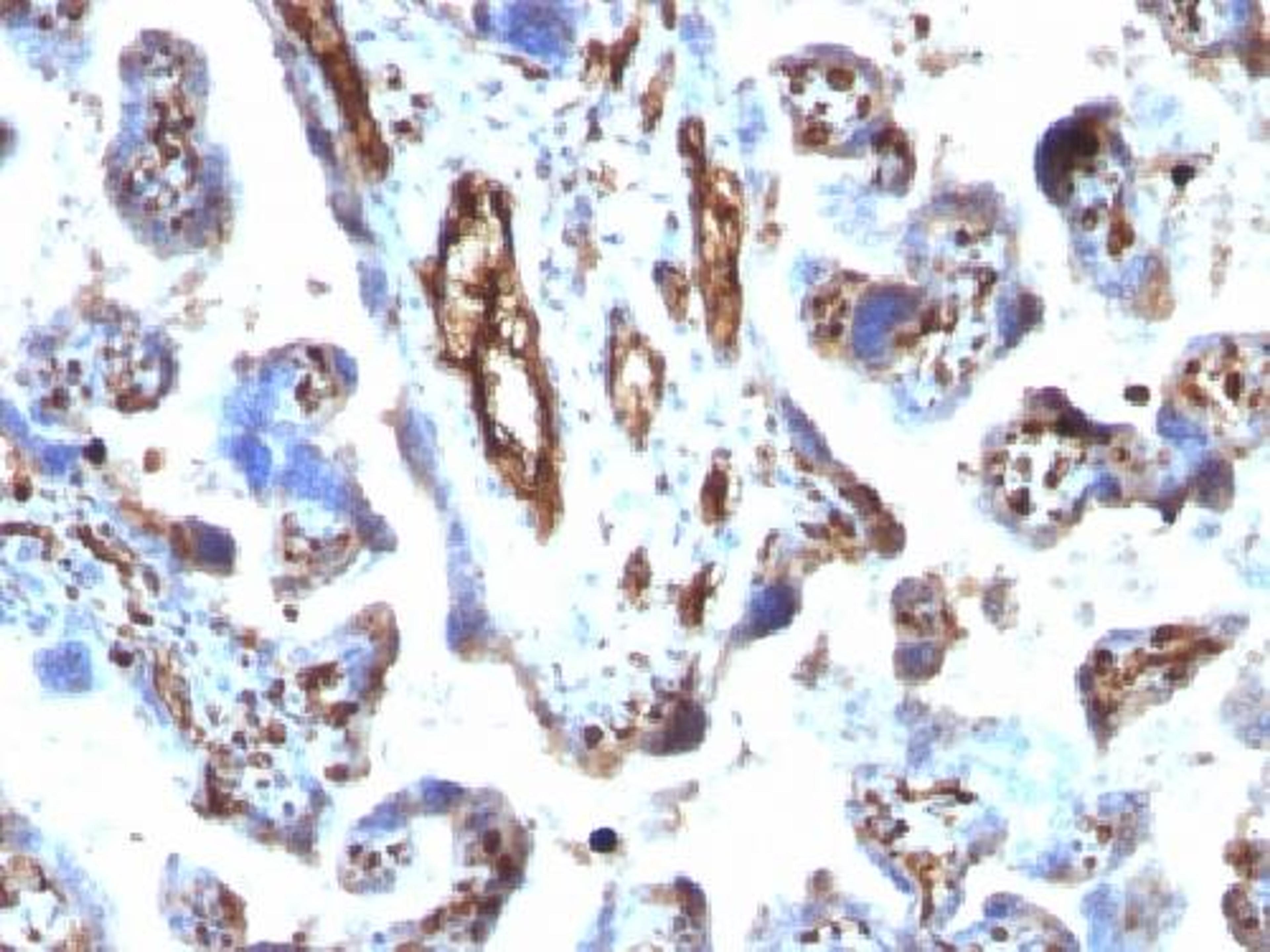 Immunohistochemical staining of human Placenta tissue using MSN antibody