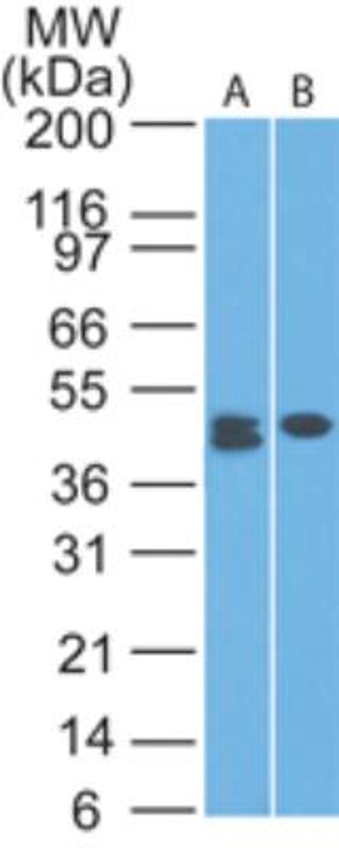 Western Blot: CLEC9A Antibody (14N8D7) [NBP2-27087] - Analysis of A) HCT-116 and B) MCF-7 lysate using this antibody at 1 ug/ml.