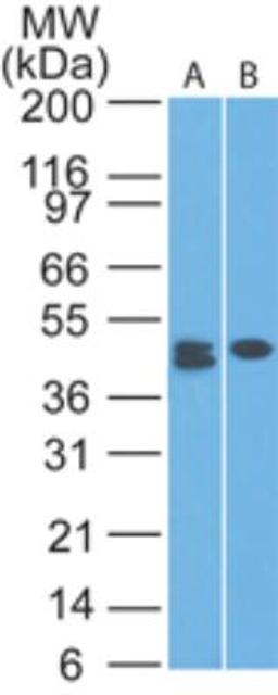 Western Blot: CLEC9A Antibody (14N8D7) [NBP2-27087] - Analysis of A) HCT-116 and B) MCF-7 lysate using this antibody at 1 ug/ml.