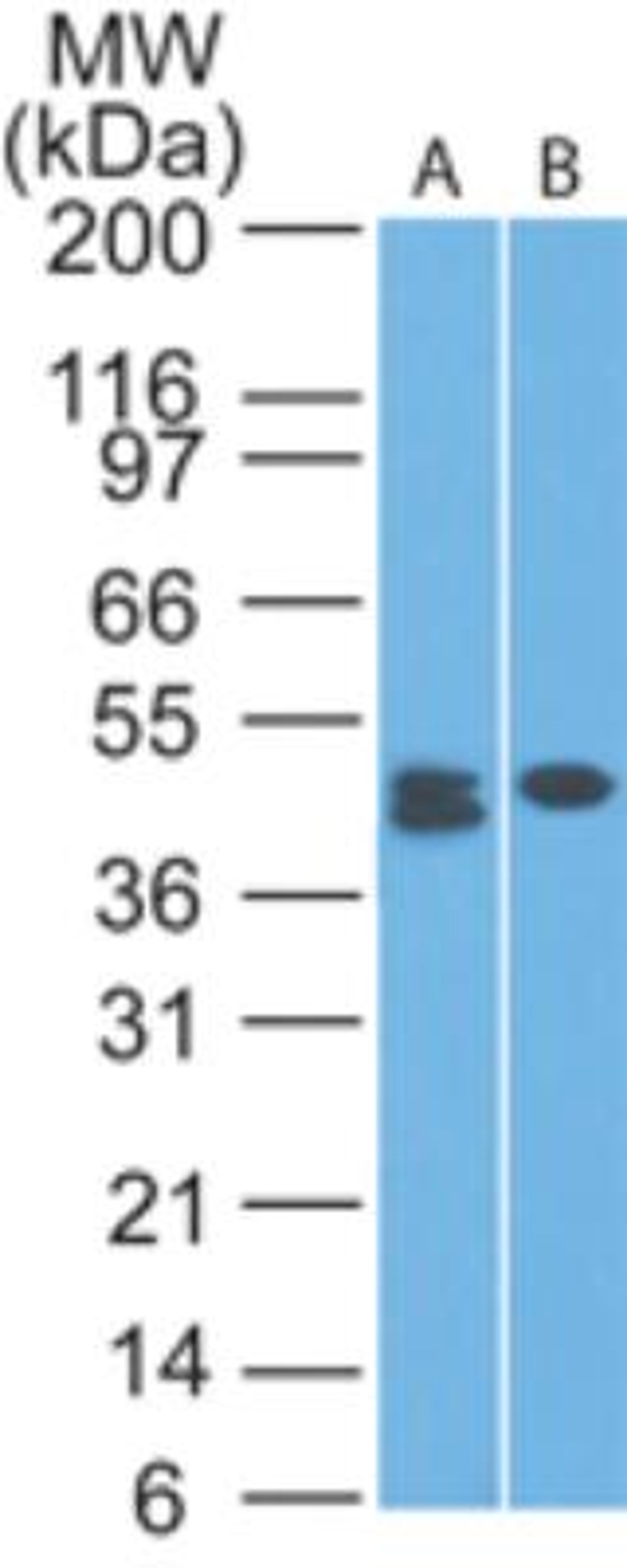 Western Blot: CLEC9A Antibody (14N8D7) [NBP2-27087] - Analysis of A) HCT-116 and B) MCF-7 lysate using this antibody at 1 ug/ml.