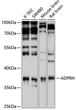 Western blot - ADPRH antibody (A6277)