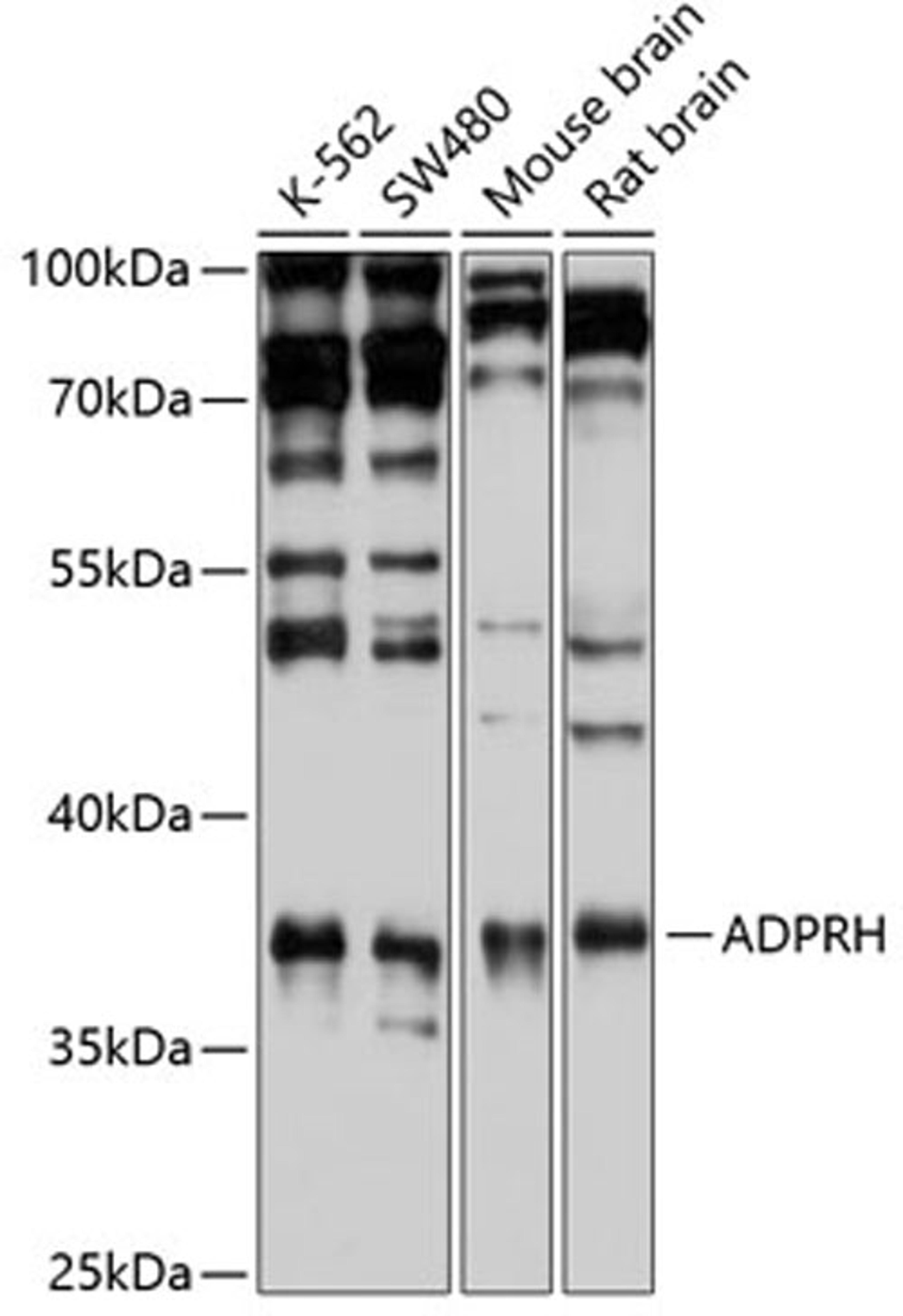 Western blot - ADPRH antibody (A6277)