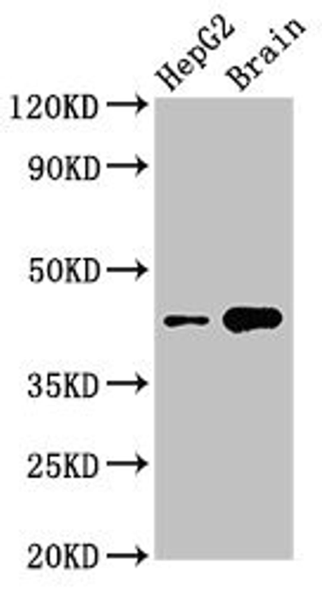 Western Blot. Positive WB detected in: HepG2 whole cell lysate, Mouse brain tissue. All lanes: STK17B antibody at 3µg/ml. Secondary. Goat polyclonal to rabbit IgG at 1/50000 dilution. Predicted band size: 43 kDa. Observed band size: 43 kDa