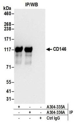 Detection of human CD146 by western blot of immunoprecipitates.