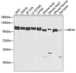 Western blot - UBE3A antibody (A1757)