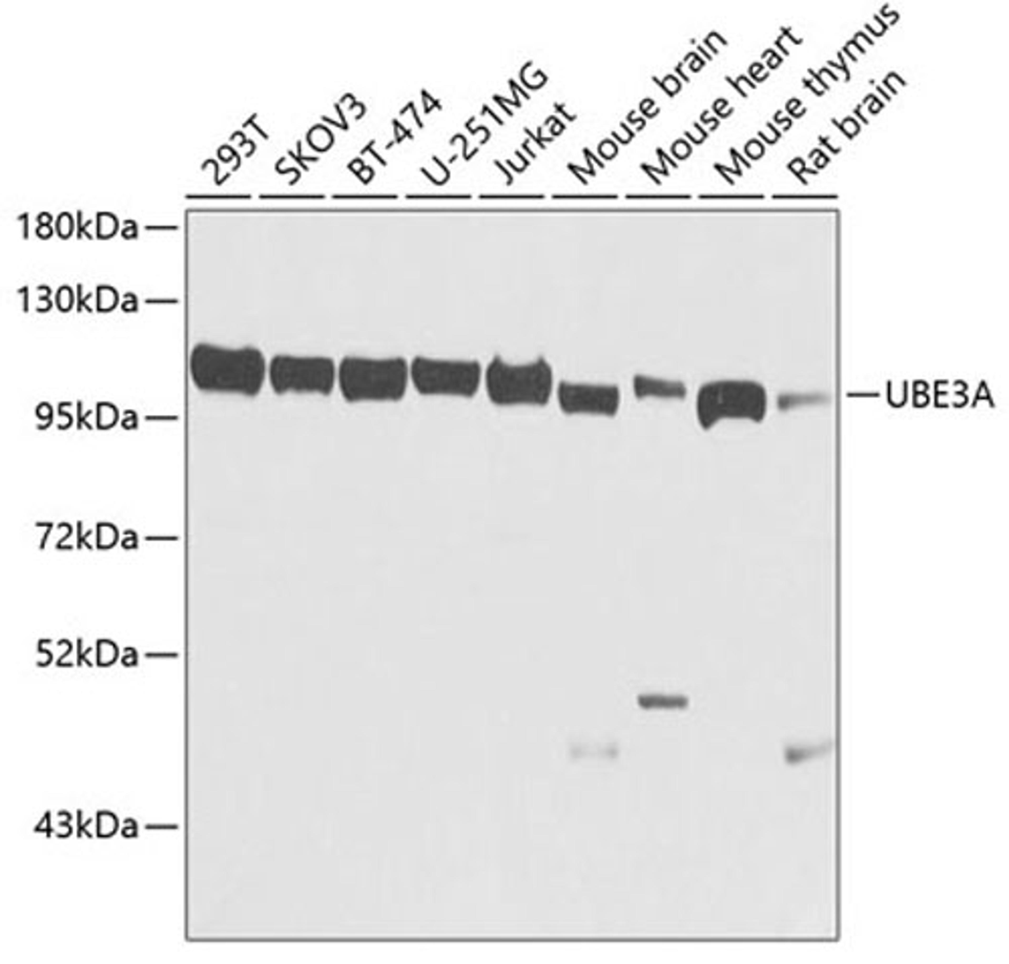 Western blot - UBE3A antibody (A1757)