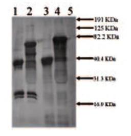 Western blot analysis of 0.5 Mouse tPA (Non-Reduced) (Lane1), 0.5 Mouse tPA+3ug CPAI (Non-Reduced) (Lane2),Mouse tPA (Reduced) (Lane3), MolecularWeight Standards (Lane4) using tPA antibody