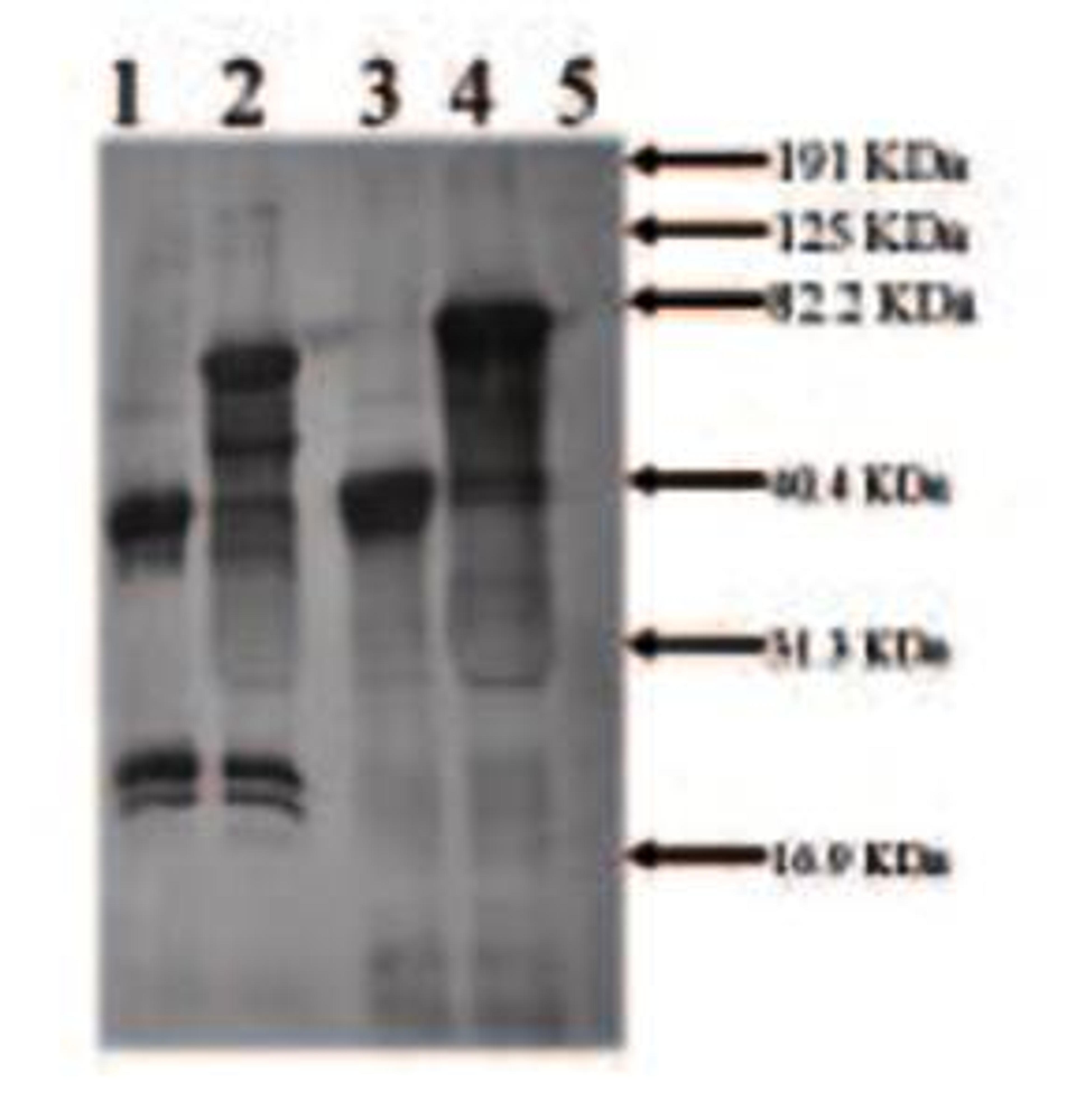 Western blot analysis of 0.5 Mouse tPA (Non-Reduced) (Lane1), 0.5 Mouse tPA+3ug CPAI (Non-Reduced) (Lane2),Mouse tPA (Reduced) (Lane3), MolecularWeight Standards (Lane4) using tPA antibody