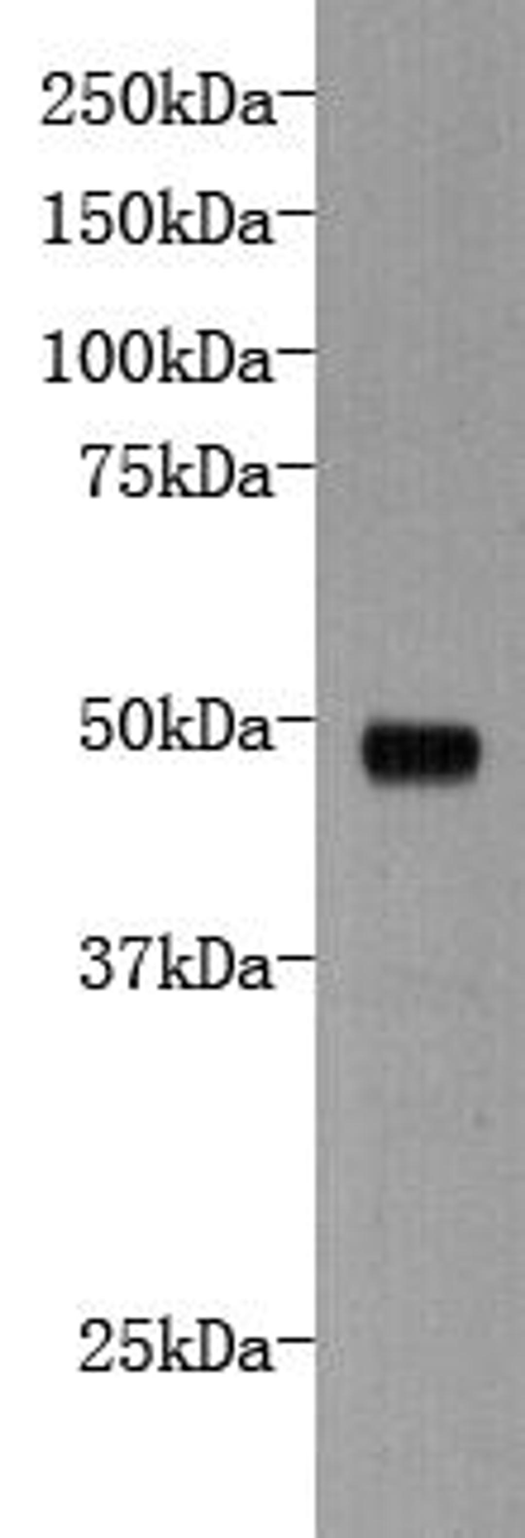 Western Blot analysis of the recombinant protein of protocadherin 16 using Protocadherin 16 antibody