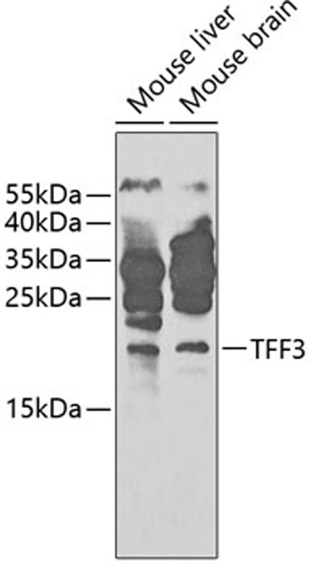 Western blot - TFF3 antibody (A1978)