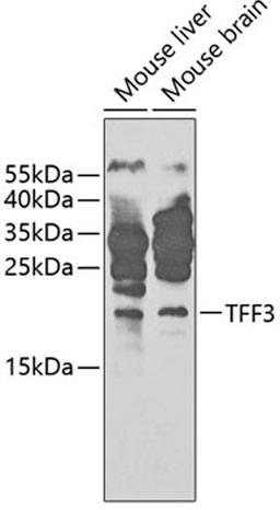 Western blot - TFF3 antibody (A1978)