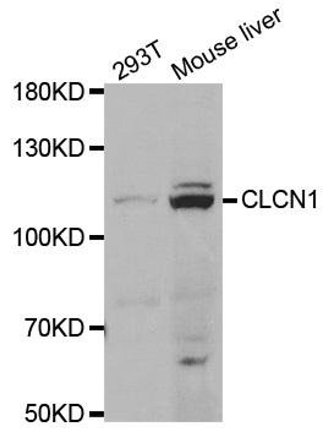 Western blot analysis of extracts of various cell lines using CLCN1 antibody