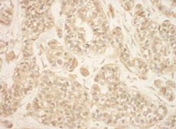 Detection of human RSK2 by immunohistochemistry.