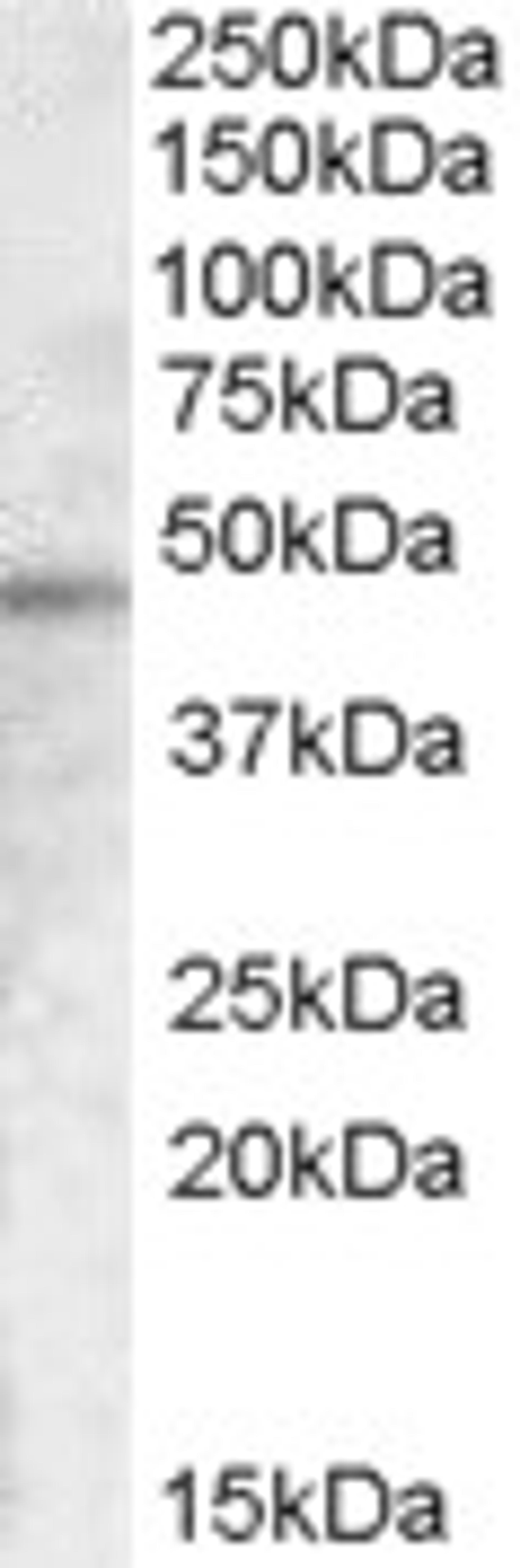 46-503 (0.1ug/ml) staining of A431 cell lysate (35ug protein in RIPA buffer). Primary incubation was 1 hour. Detected by chemiluminescence.