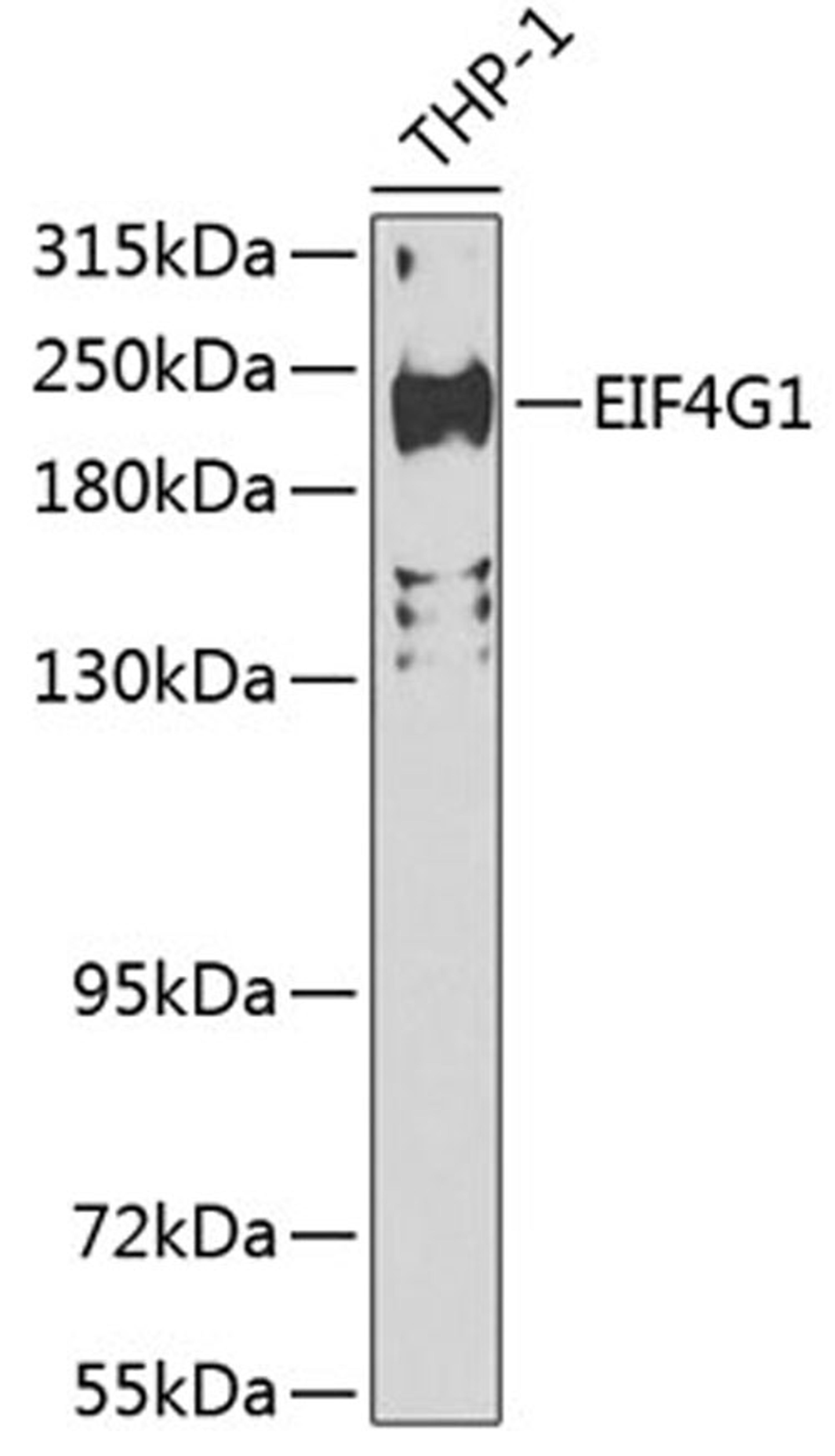 Western blot - EIF4G1 Antibody (A7552)