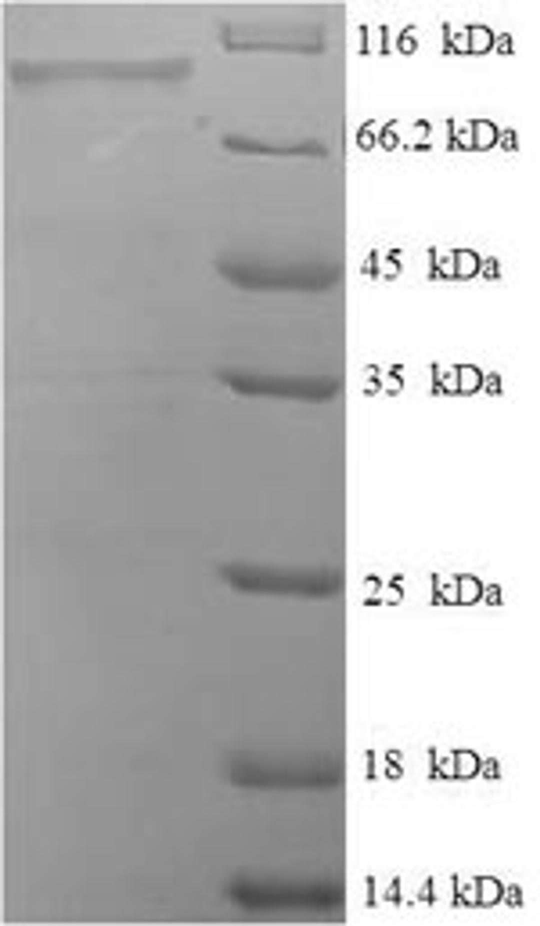 (Tris-Glycine gel) Discontinuous SDS-PAGE (reduced) with 5% enrichment gel and 15% separation gel.