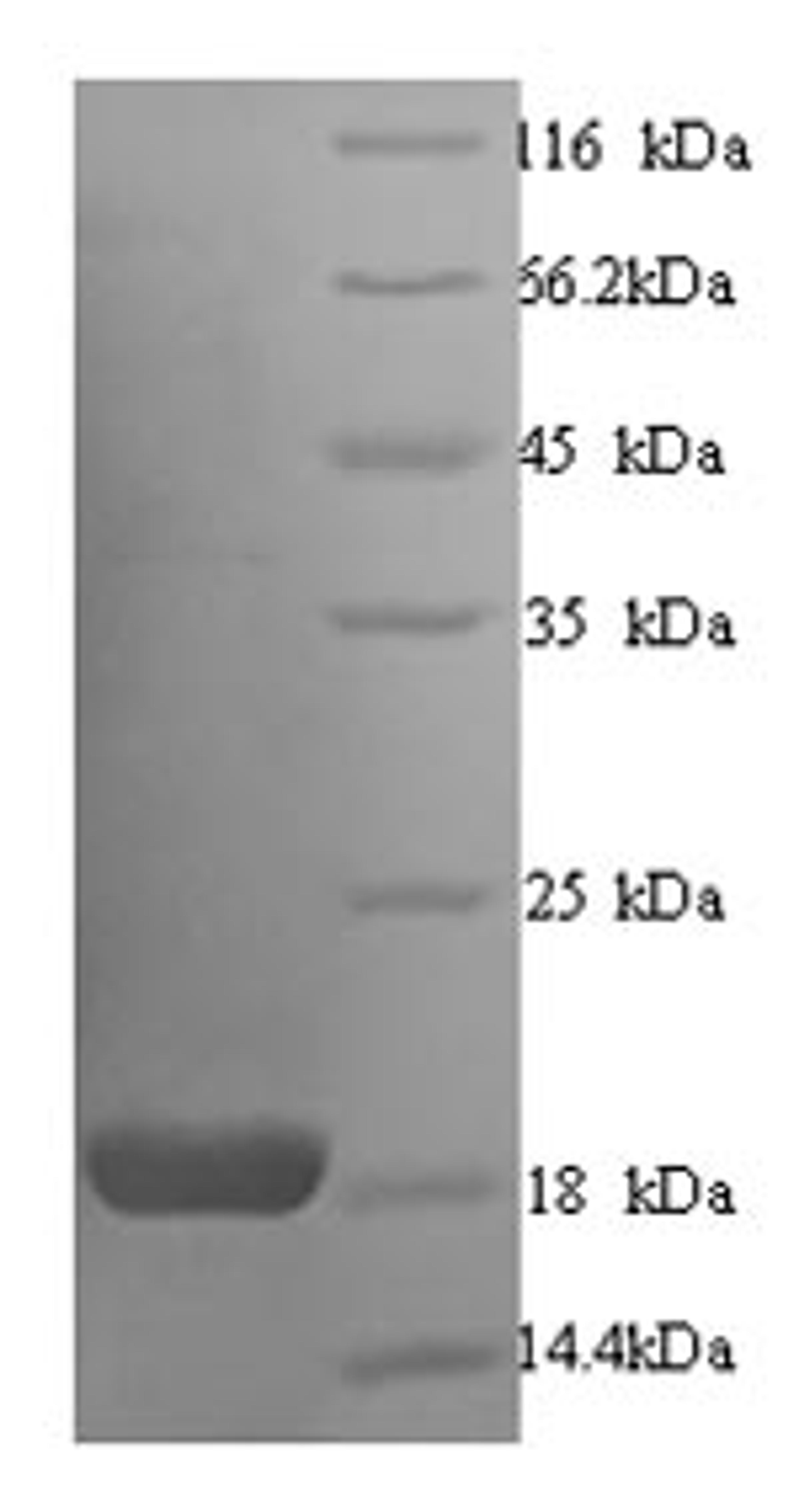 (Tris-Glycine gel) Discontinuous SDS-PAGE (reduced) with 5% enrichment gel and 15% separation gel.