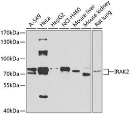 Western blot - IRAK2 antibody (A6635)